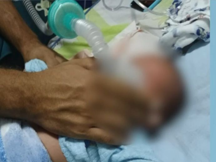 Beb&ecirc; com 25 dias de nascido, teve uma piora ap&oacute;s ser transferido de ambul&acirc;ncia para outro Hospital