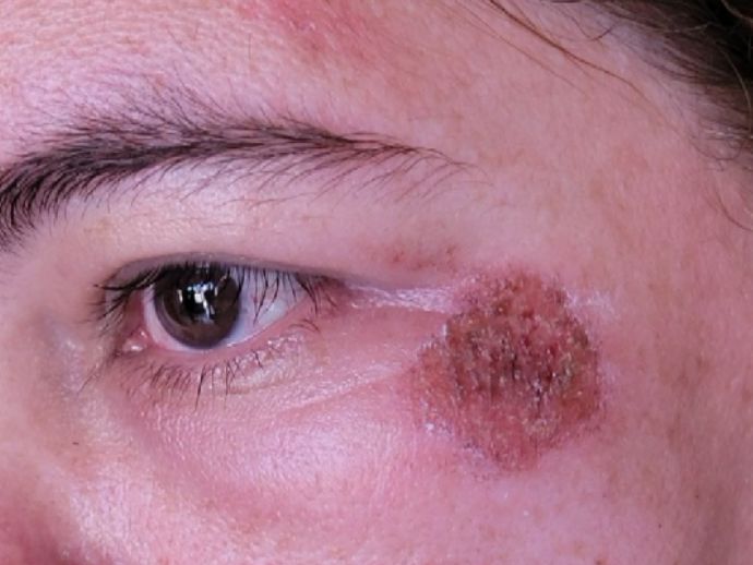 Mulher &eacute; espancada e amea&ccedil;ada por assaltantes, em Jaboat&atilde;o dos Guararapes
