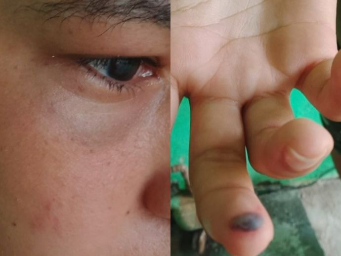 Mulher de 22 anos denuncia agress&atilde;o pelo marido no bairro de Prazeres
