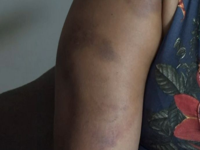 Homem tenta matar ex-mulher por n&atilde;o aceitar o t&eacute;rmino do relacionamento em Olinda