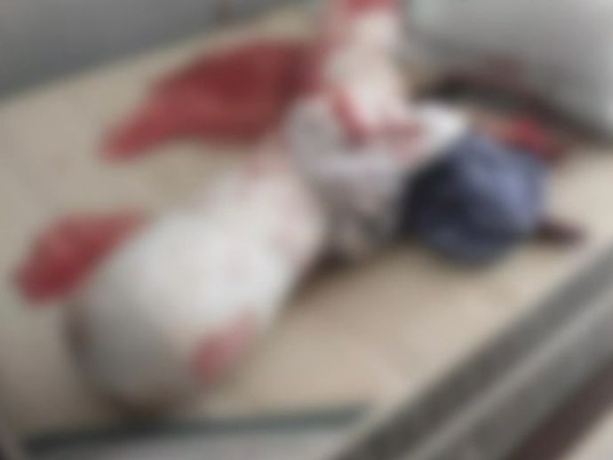 Mulher de 39 anos &eacute; esfaqueada pelo ex-marido em Jaboat&atilde;o dos Guararapes