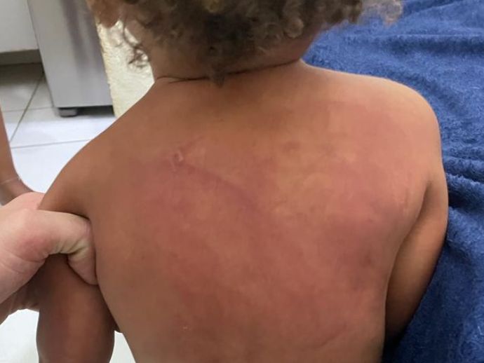M&atilde;e &eacute; presa por agredir filho de um ano em Macei&oacute;