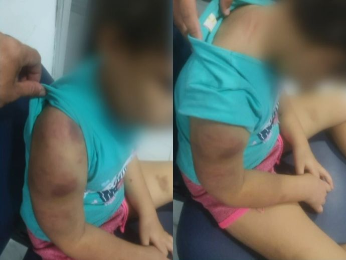 Mulher &eacute; detida por maus tratos e les&atilde;o corporal contra filha de seis anos em Paulista
