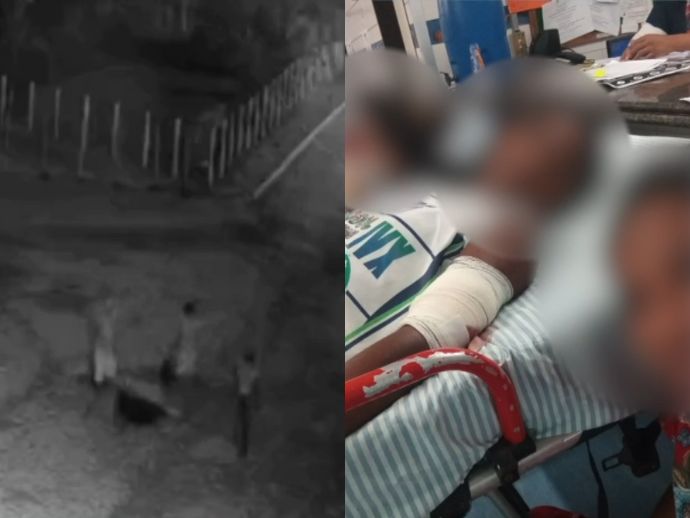 Menino de 11 anos &eacute; atacado por c&atilde;o da ra&ccedil;a Rottweiler em &Aacute;gua Preta