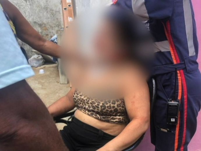 Mulher &eacute; agredida e torturada pelo namorado no bairro de &Aacute;gua Fria