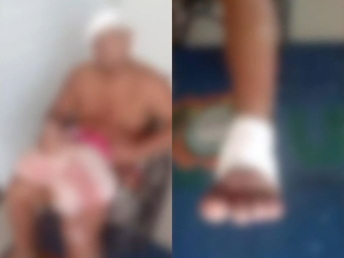 Homem &eacute; atacado por c&atilde;o da ra&ccedil;a pitbull em Afogados