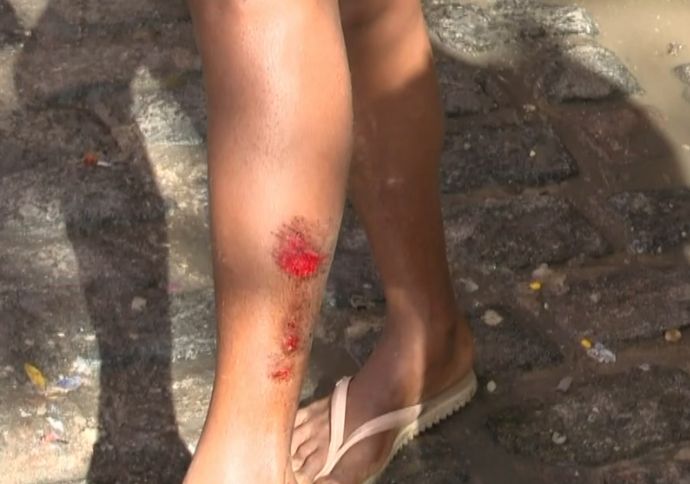 Tiroteio no encerramento do carnaval de Olinda deixa sete pessoas feridas