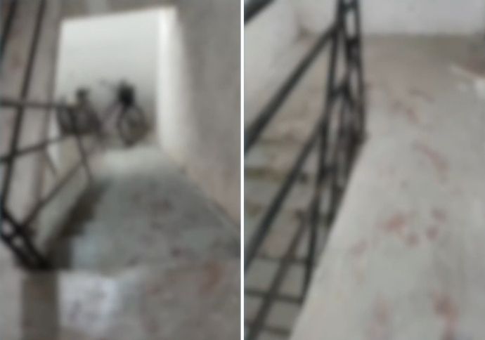 Mulher é agredida com facão por ex-companheiro no bairro dos Torrões