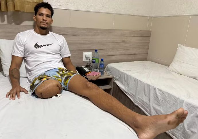 Delegado Luiz Alberto Braga é denunciado por tentativa de homicídio qualificado contra ambulante de Noronha