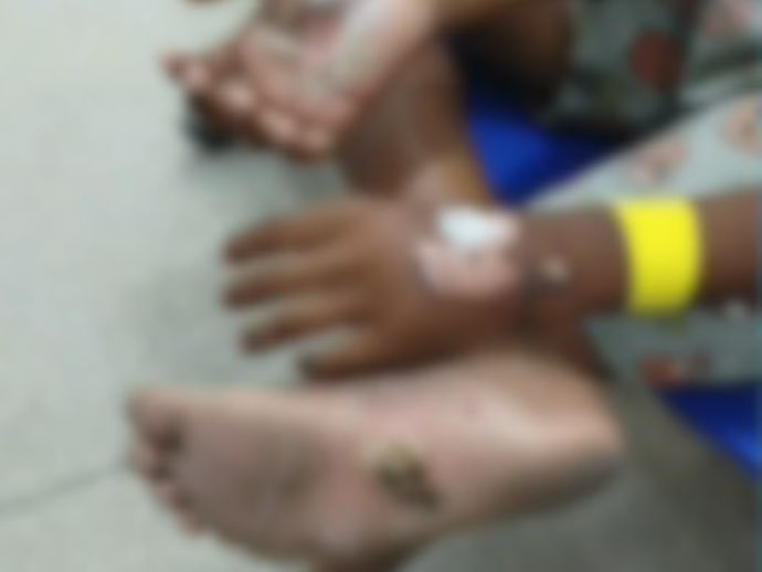 M&atilde;e &eacute; presa suspeita de queimar filho de 10 anos com colher quente em Jaboat&atilde;o