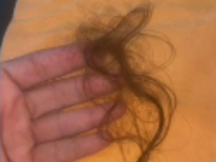 Pol&iacute;cia ouve suspeito de atacar mulheres cortando cabelos em bairros do Recife