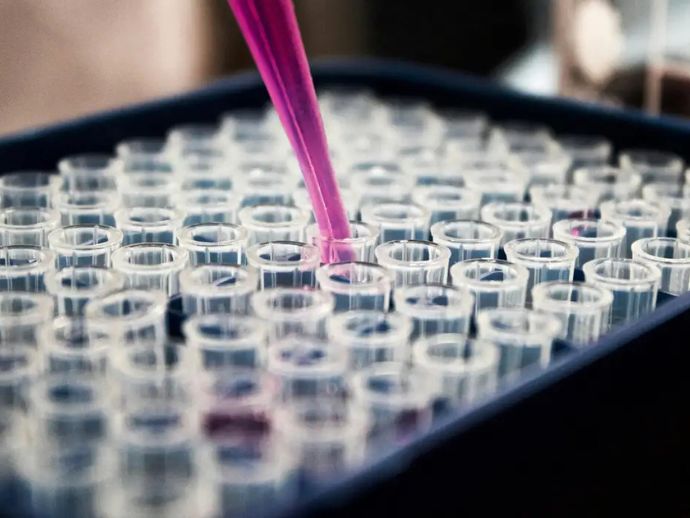 Pesquisas brasileiras avan&ccedil;am no diagn&oacute;stico de Alzheimer