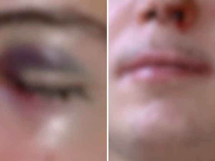 Em Ribeir&atilde;o, estudante de 16 anos &eacute; espancado por colegas dentro de escola estadual