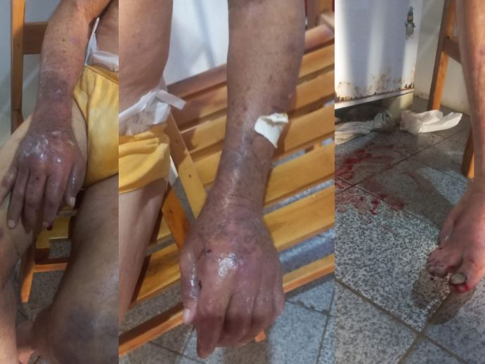 Mulher &eacute; presa por maus-tratos ap&oacute;s pol&iacute;cia encontrar pai de 84 anos em situa&ccedil;&atilde;o de risco em Belo Monte