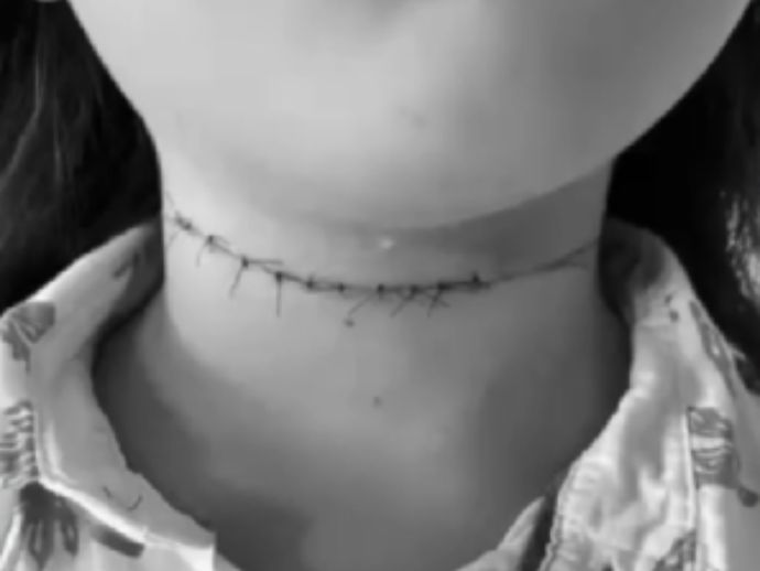 Menino de 10 anos fica ferido no pesco&ccedil;o ap&oacute;s ser atingido por linha com cerol 