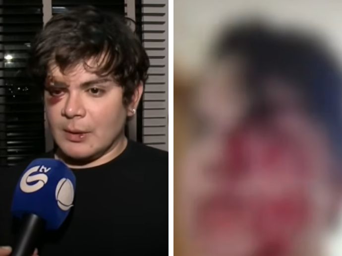 Morador &eacute; espancado por vizinho ap&oacute;s invas&atilde;o de domic&iacute;lio e ataques homof&oacute;bicos no Recife