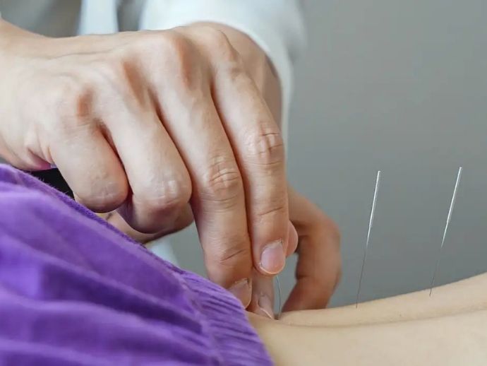 Brasil regulamenta exerc&iacute;cio profissional da acupuntura