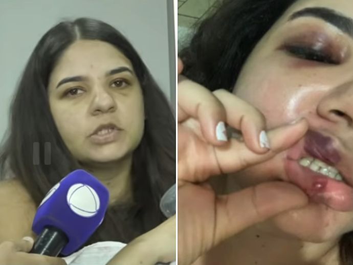 Mulher &eacute; v&iacute;tima de tentativa de feminic&iacute;dio ap&oacute;s descumprimento de medida protetiva em Jaboat&atilde;o dos Guararapes