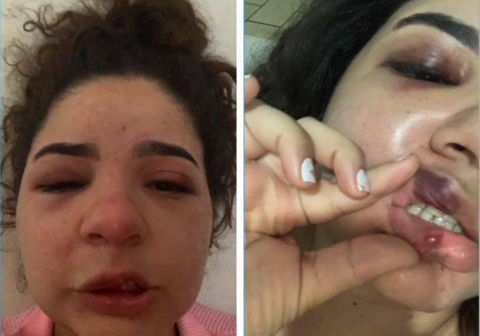 Homem descumpre medida protetiva e agride ex-companheira em Jaboat&atilde;o