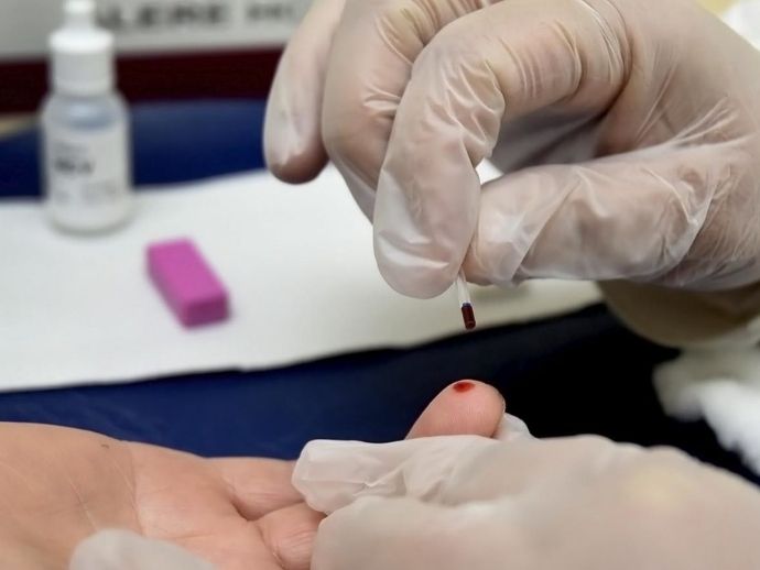 Universidades brasileiras participam de pesquisa para cura da hepatite B