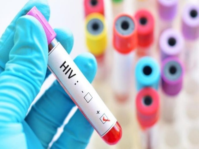 Cientistas descobrem nova pista para controlar v&iacute;rus HIV, revela pesquisa