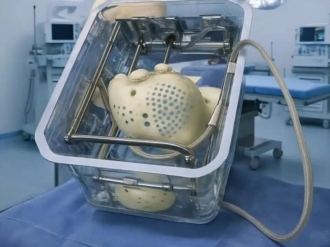 Cora&ccedil;&atilde;o artificial franc&ecirc;s traz esperan&ccedil;a para quem espera por transplante