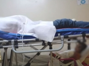 Adolescente de 15 anos &eacute; v&iacute;tima de agress&atilde;o na Zona Sul do Recife