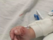 Beb&ecirc; de 10 meses espancado pela m&atilde;e est&aacute; com traumatismo cranioencef&aacute;lico, segundo informa&ccedil;&otilde;es m&eacute;dicas