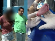 Beb&ecirc; de tr&ecirc;s meses morre em hospital com sinais de tortura