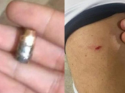 Homem &eacute; atingido por bala perdida dentro de lanchonete em Arapiraca
