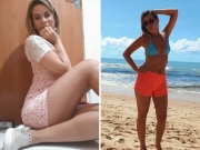 Cremepe investiga medico responsável por procedimento estético que matou mulher no Recife