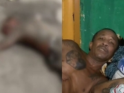 Homem sobrevive a queda de 8 metros de altura e luta por recupera&ccedil;&atilde;o no Espinheiro