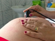 Exame pr&eacute;-natal reduz chance de beb&ecirc; nascer com anomalia