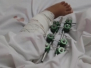 Tiroteio entre criminosos deixa uma criança morta e outra ferida na Zona Norte do Recife