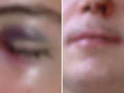 Em Ribeir&atilde;o, estudante de 16 anos &eacute; espancado por colegas dentro de escola estadual