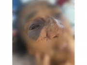 Idosa de 88 anos é espancada dentro de casa na Zona da Mata Norte