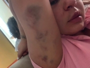 Homem descumpre medida protetiva e agride ex-companheira em Jaboatão