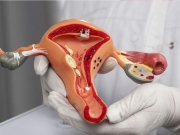 CNPq abre chamamento público para pesquisas sobre endometriose
