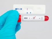 Estudo elimina HIV em primatas com três terapias combinadas. Saiba mais!