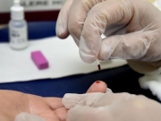 Universidades brasileiras participam de pesquisa para cura da hepatite B