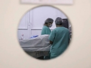 Melanoma pode surgir fora da pele e exige atenção ao diagnóstico