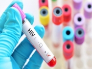 Cientistas descobrem nova pista para controlar vírus HIV, revela pesquisa